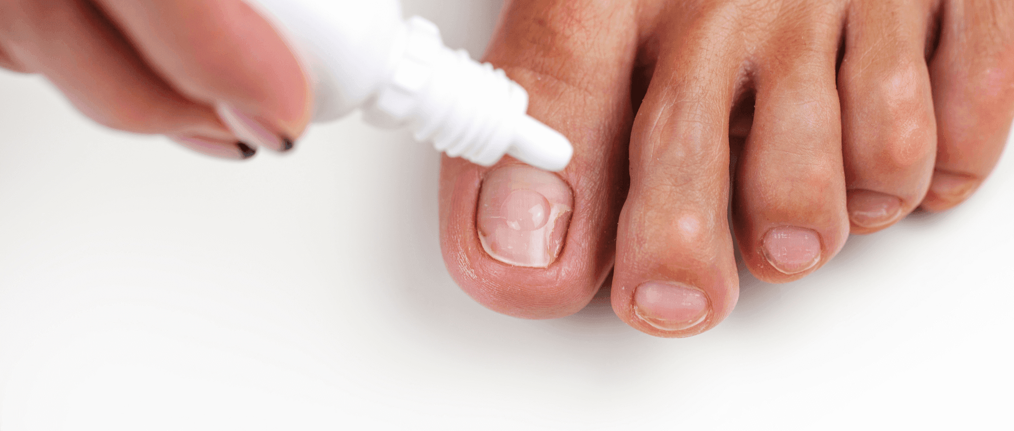 A dropper on the toe nail